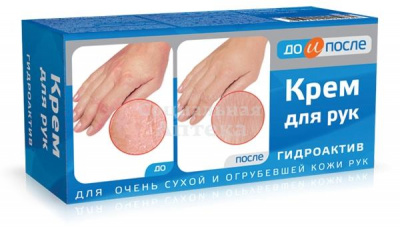 До и После крем д/рук гидроактив 100мл